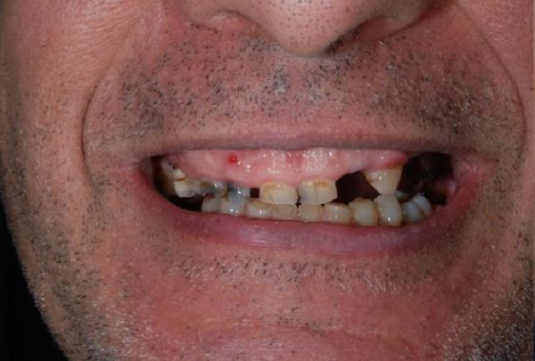 Caso Clinico A - Prima