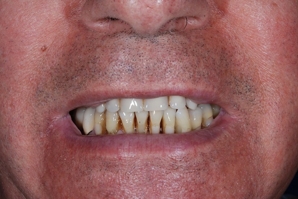 Caso Clinico B - Prima