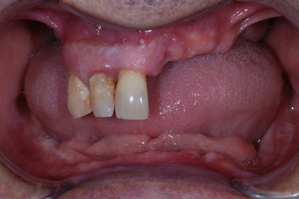 Caso Clinico C - Prima