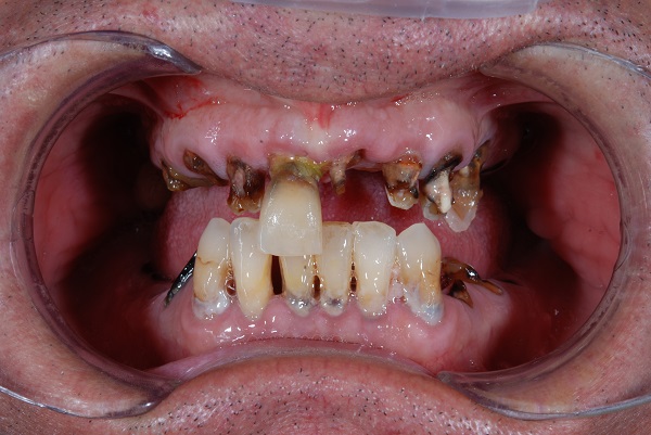 Caso Clinico D - Prima